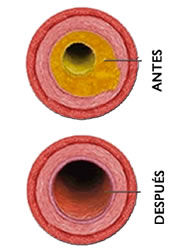 limpiar venas y arterias